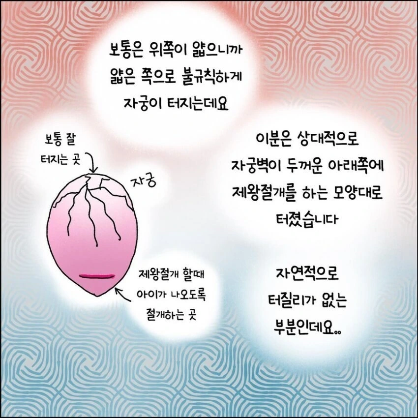 산부인과에서 출산 중 자궁이 파열되는 만화.manhwa - 이미지 8