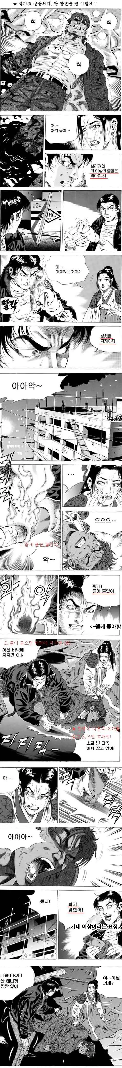 전설의 김성모식 절단상 치료.manga